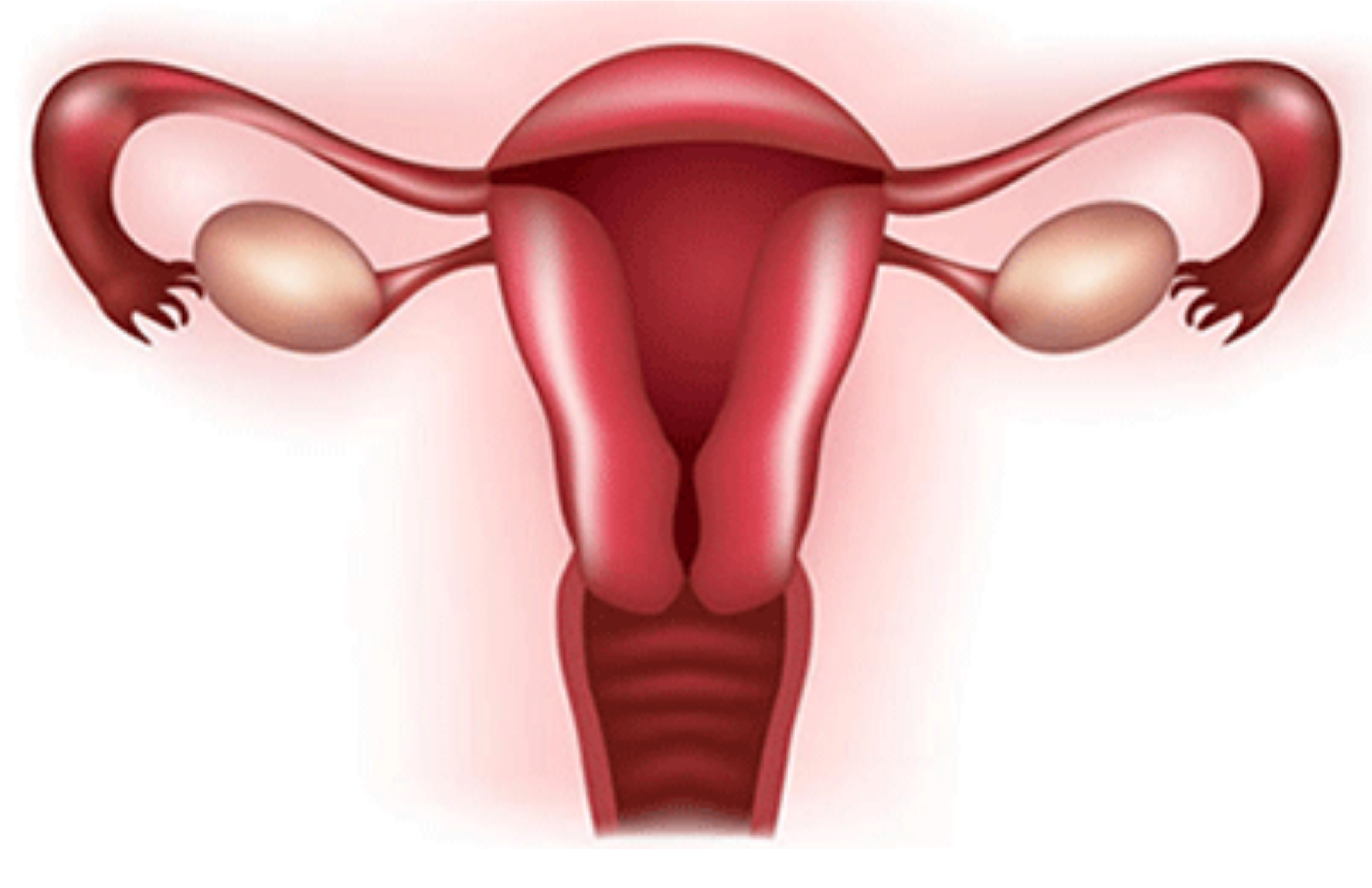 Disfunctional Uterine Bleeding (DUB)