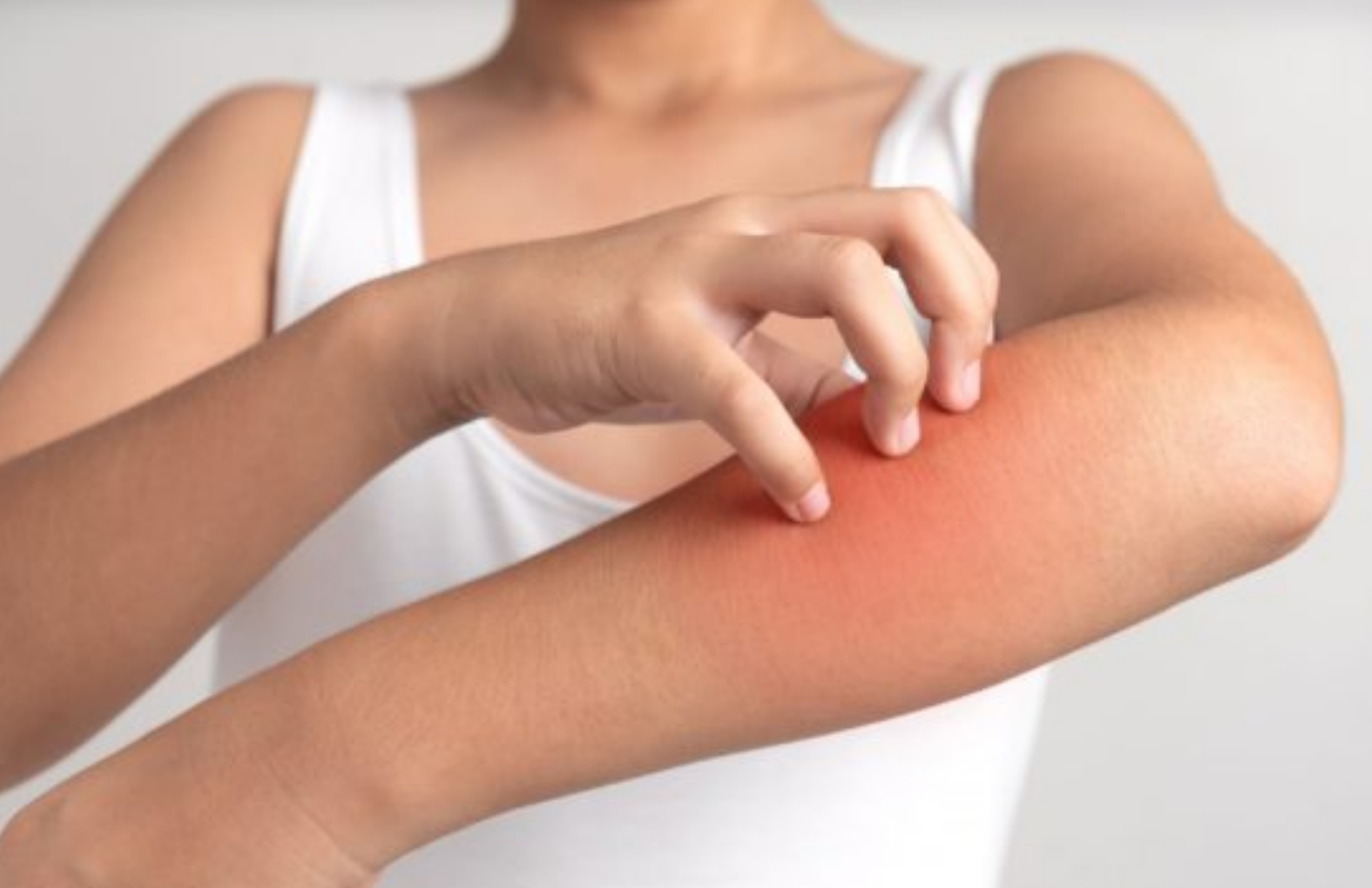 Skin Allergy