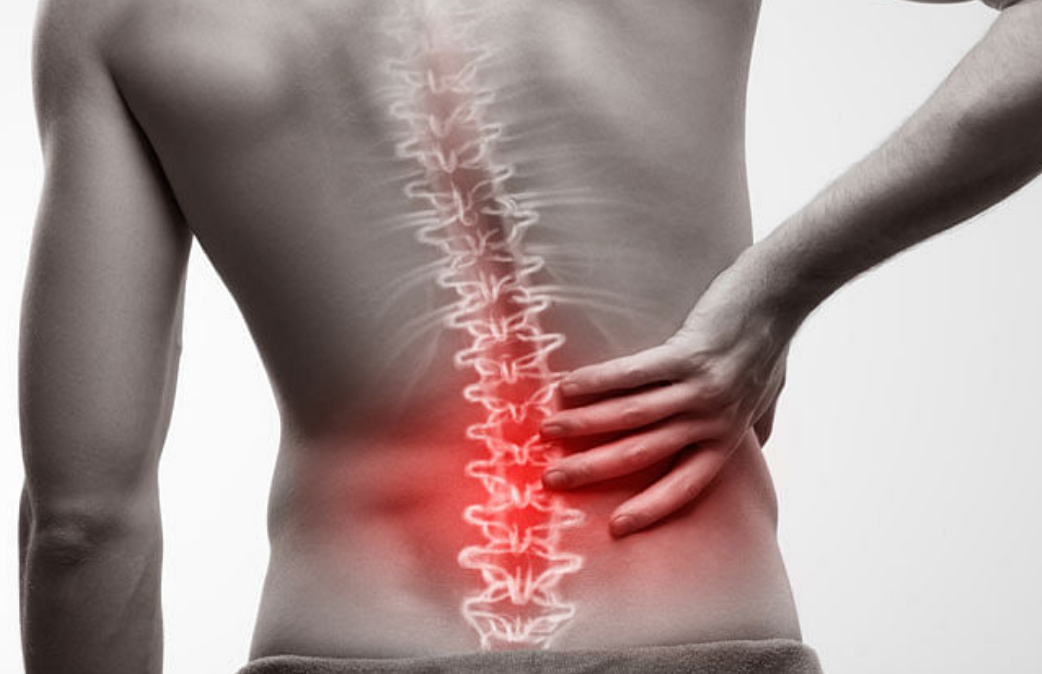 Ankylosing Spondylosis