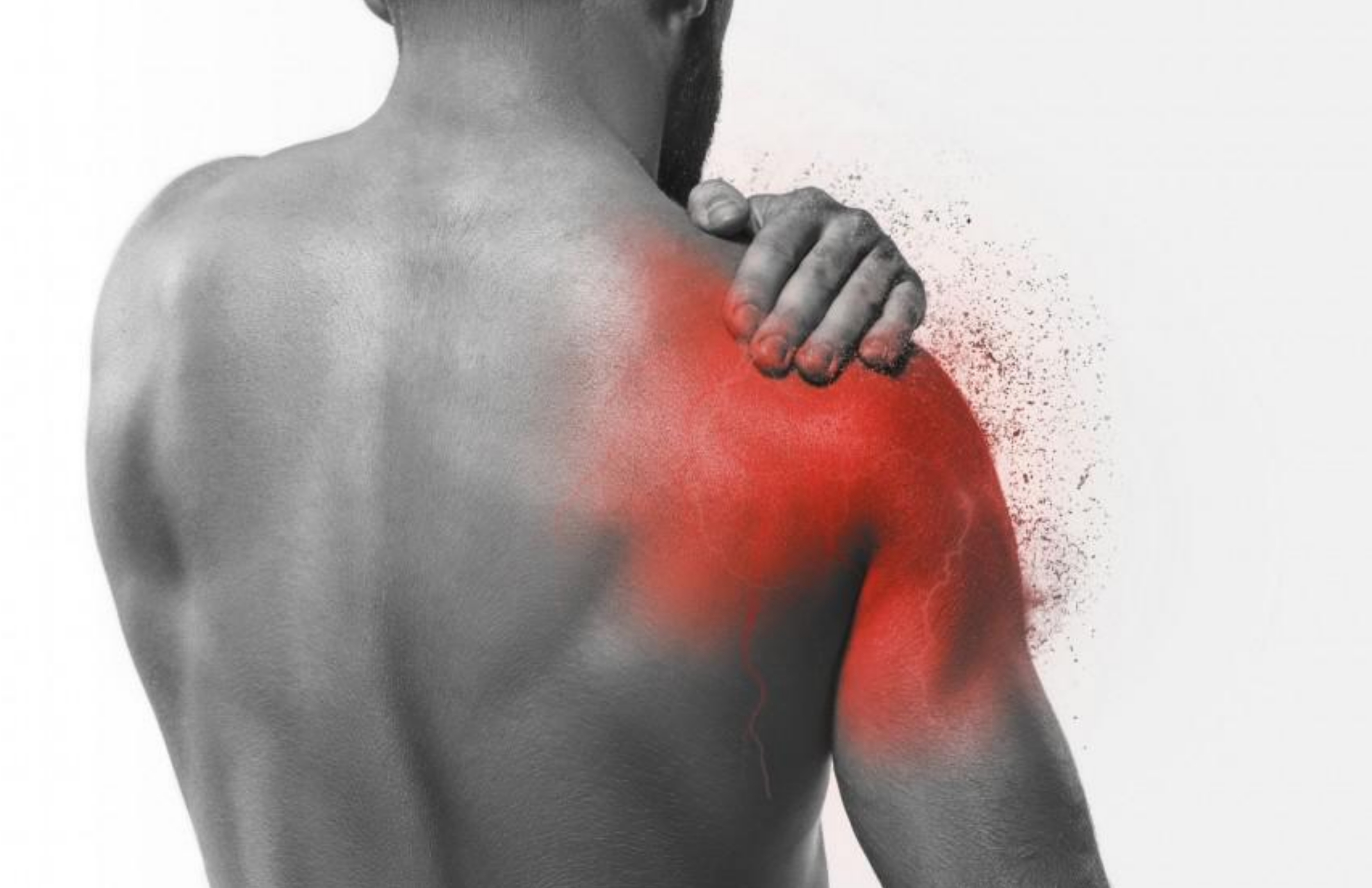 Frozen Shoulder