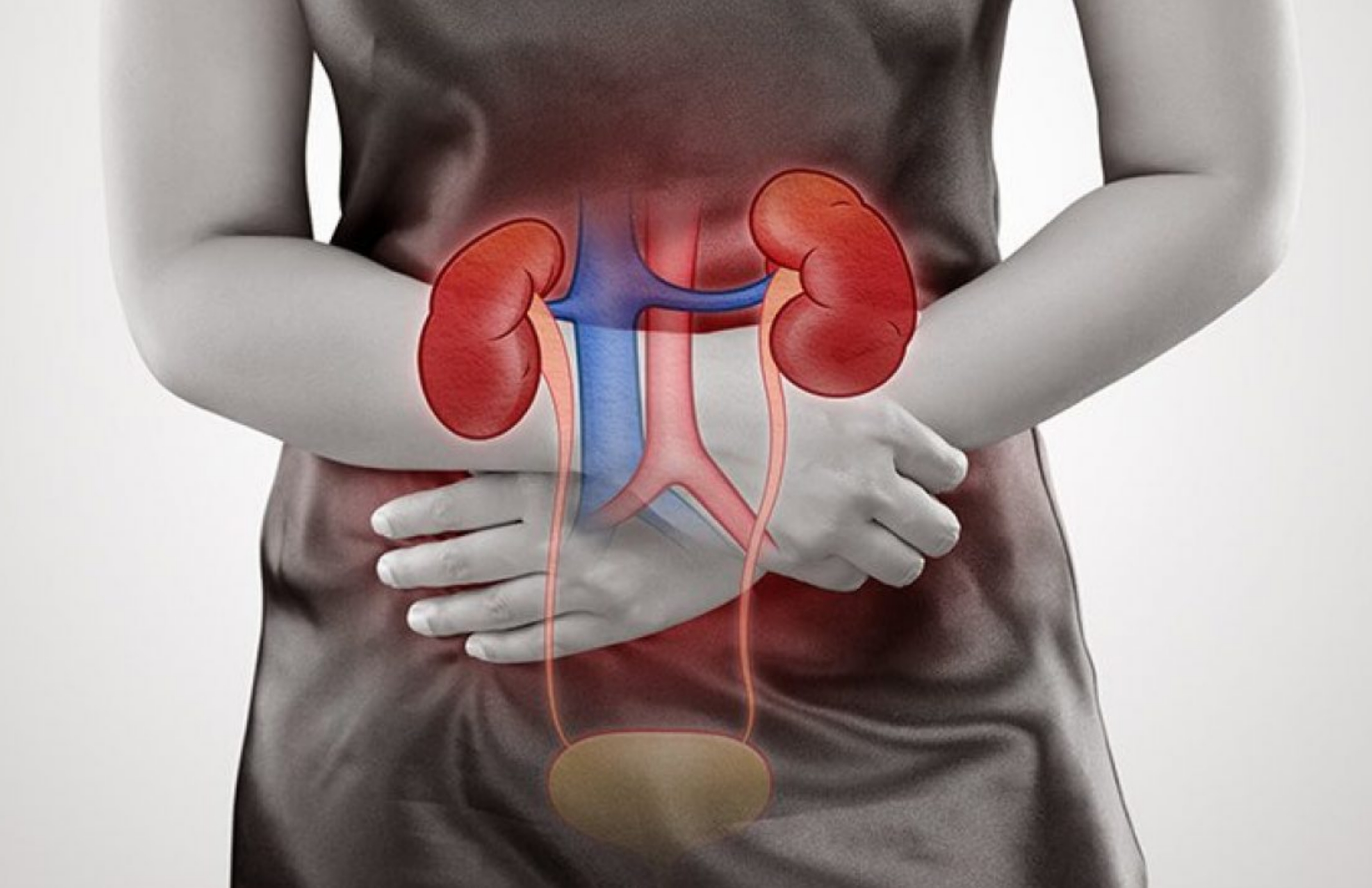 Chronic Kidney Disease ( CKD )/ ( CRF )
